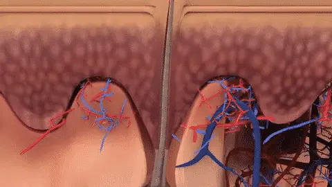 KeraFactor_GIF